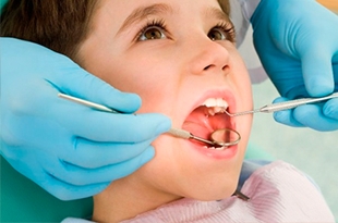 Ortodontia preventiva